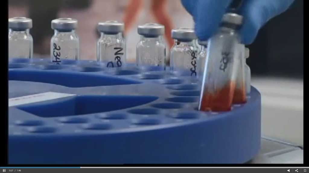 Can You Fight a DUI if the Blood Test Shows You're Over The Legal Limit?