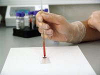 Blood test results are more reliable than results from PAS devices.